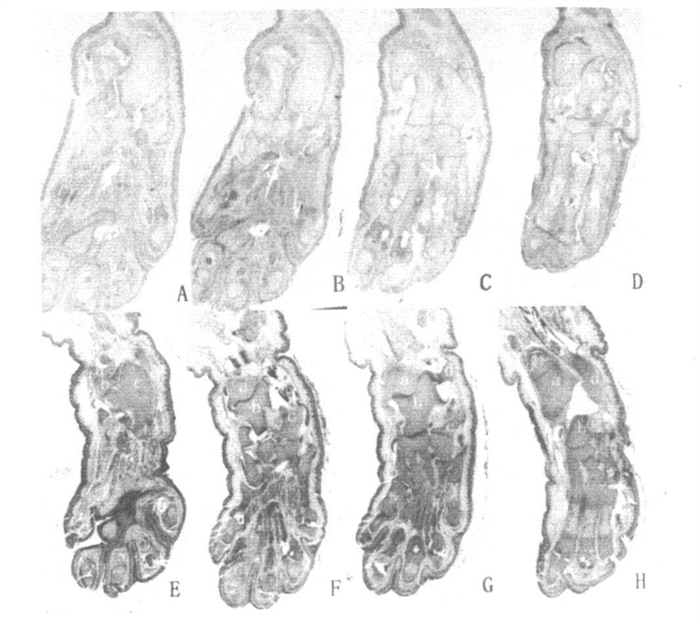 Study on rat fetuses talipes equinovarus model induced by alltrans