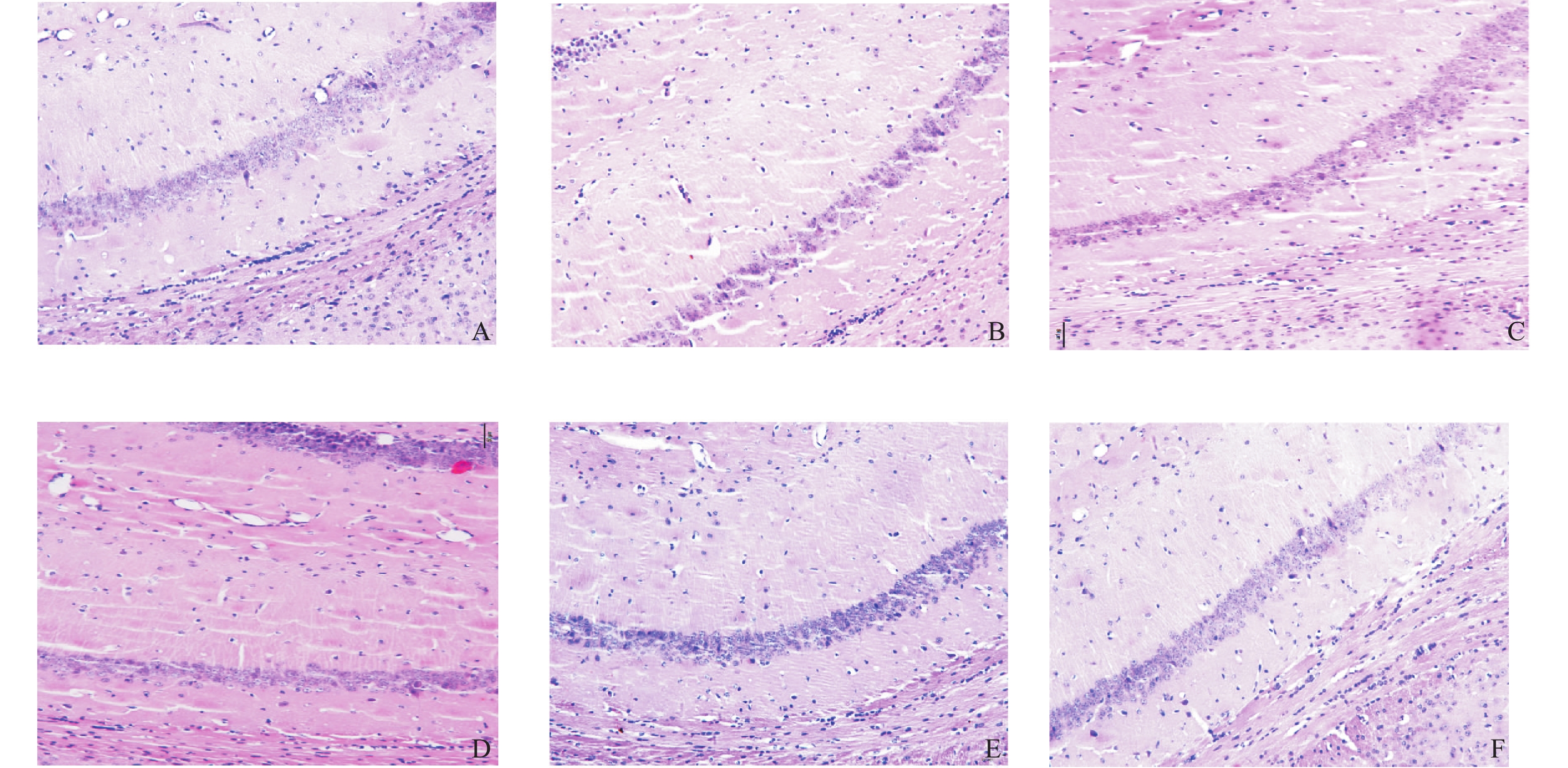 doi: 10小鼠海马区切片图脑 he海马切片小鼠海马齿状回小鼠脑he小鼠