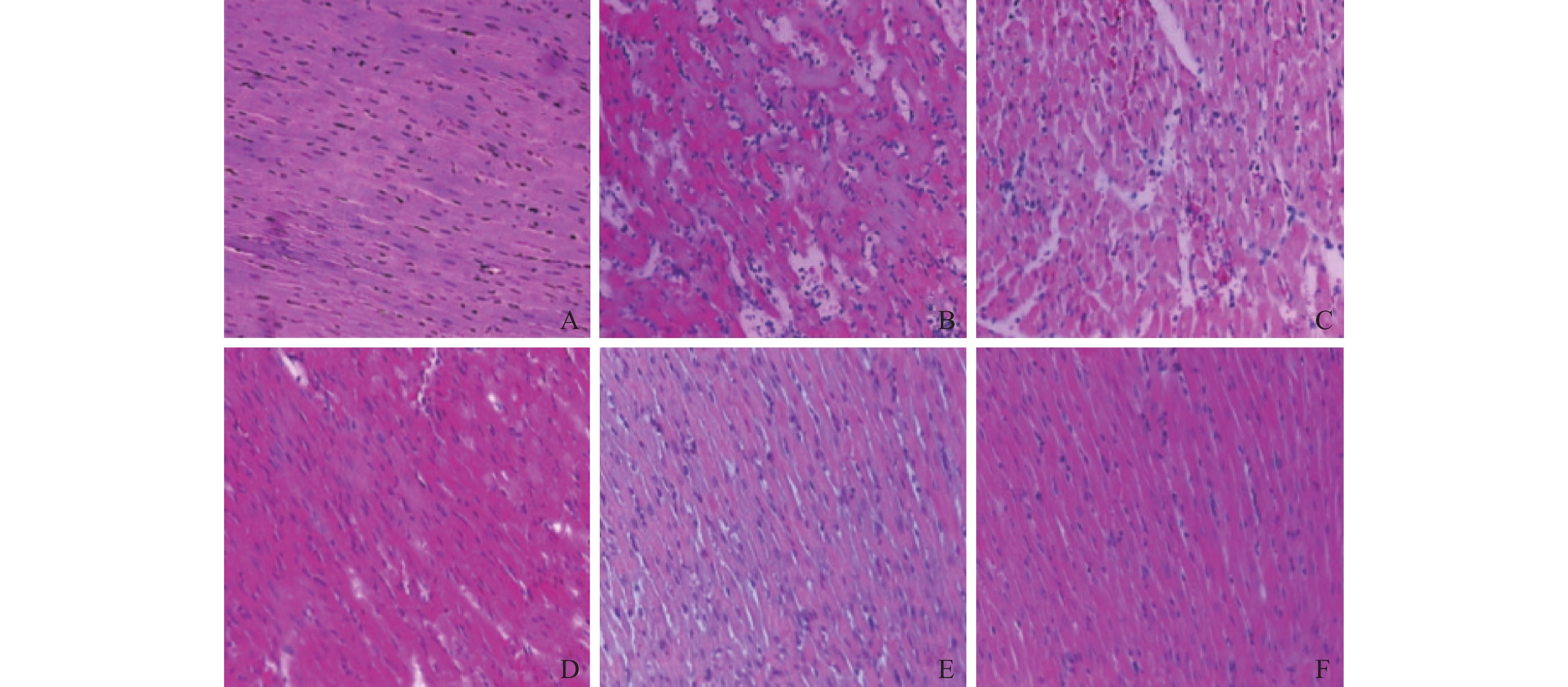 刘访遥, 袁娜, 王平. 川芎嗪对急性心肌梗死大鼠保护作用及机制[j].
